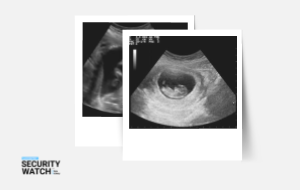 Diagnostic Firm Leaks Fetal Ultrasounds Diagnostic Firm Leaks Fetal Ultrasounds