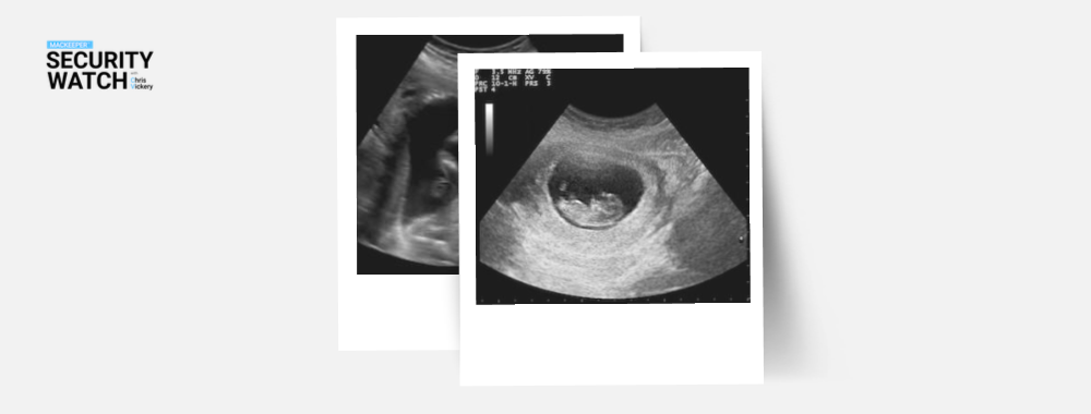 Diagnostic Firm Leaks Fetal Ultrasounds Diagnostic Firm Leaks Fetal Ultrasounds